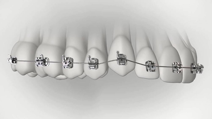 承德市哪家口腔醫(yī)院口腔正畸做得好？惟德口腔醫(yī)院來(lái)告訴您