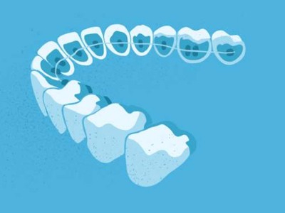 惟德口腔醫(yī)院口腔正畸好不好？