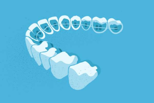 惟德口腔醫(yī)院口腔正畸好不好？